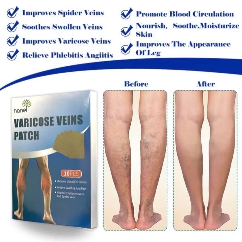 HANEL VARICOSE VEINS PATCH - ภาพที่ 5
