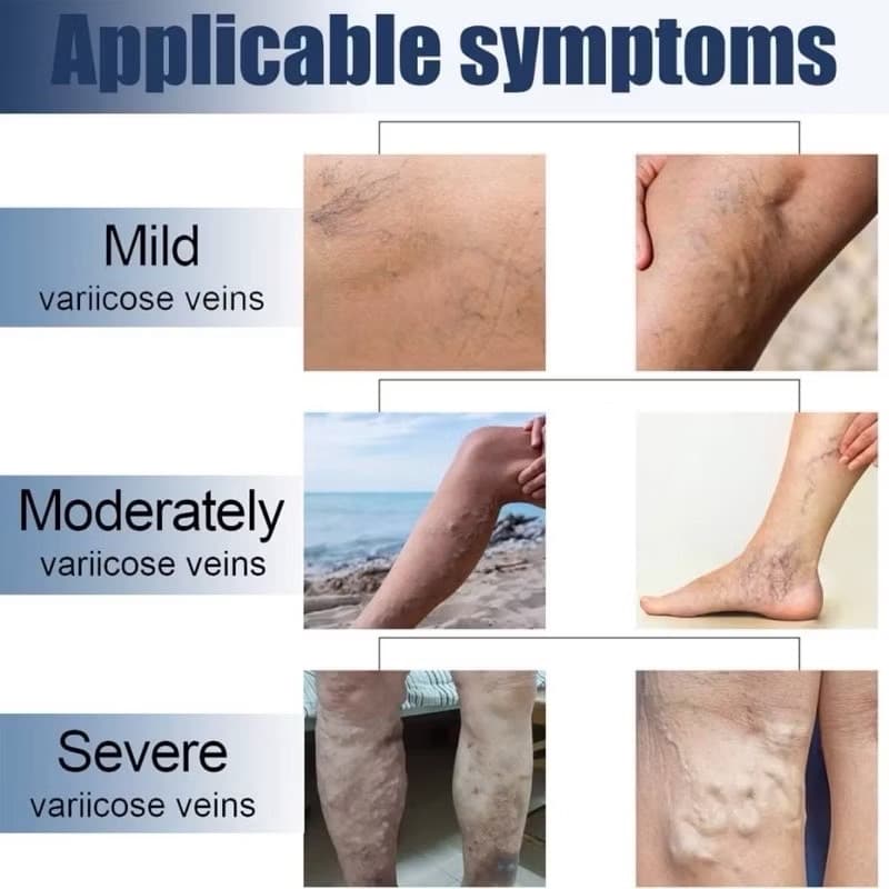 HANEL VARICOSE VEINS PATCH - ภาพที่ 8