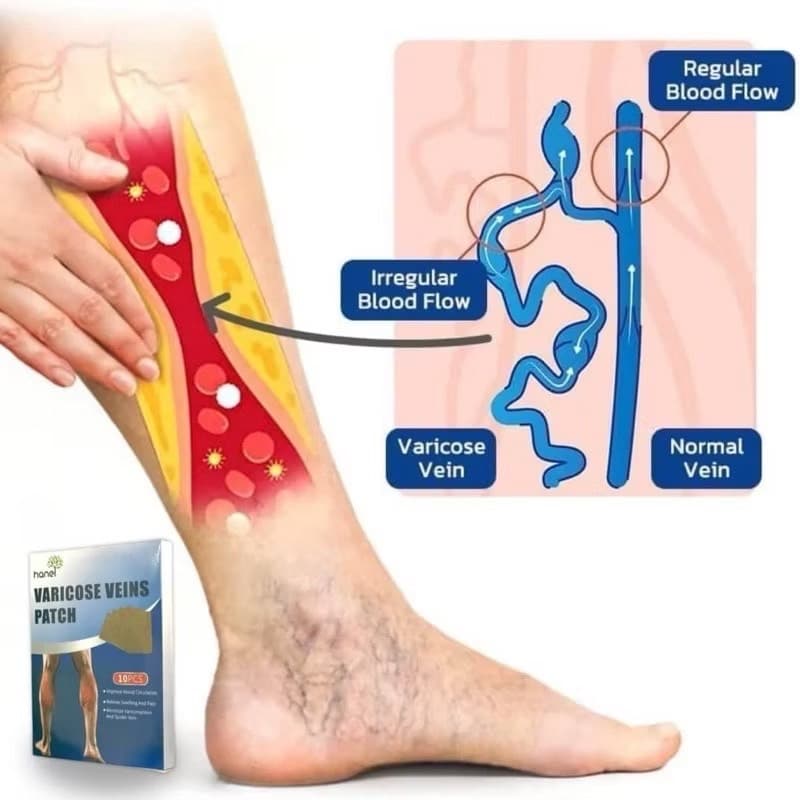HANEL VARICOSE VEINS PATCH - ภาพที่ 4