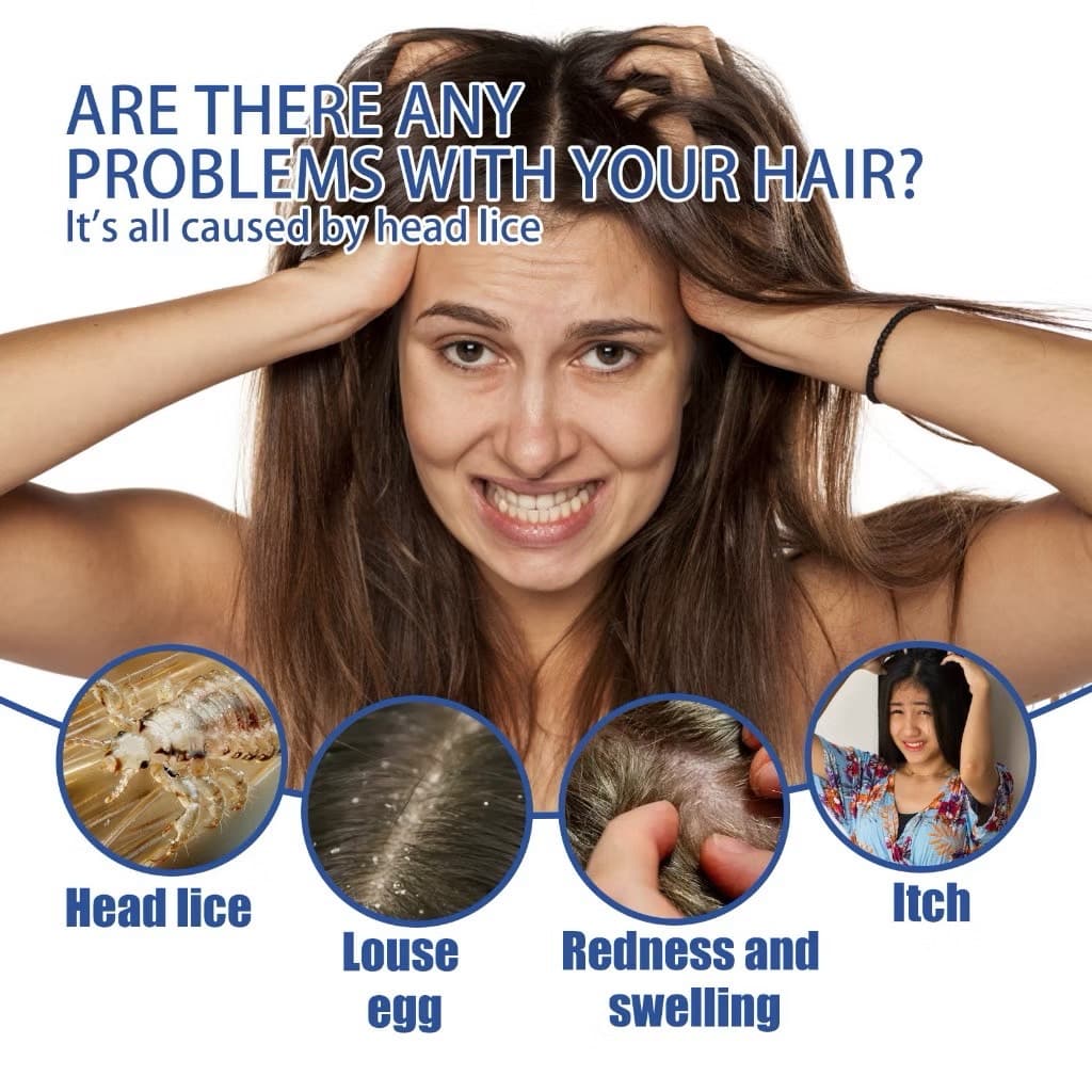 SOUTH MOON SCABIES LICE SPRAY - ภาพที่ 4