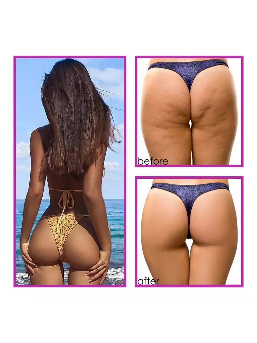 KISS BEAUTY HIP ENHANCEMENT CREAM - ภาพที่ 6